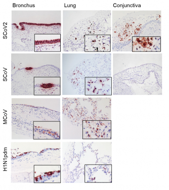 Human respiratory tract and eye explants: The image shows the coronavirus and influenza virus infected cells (in red colour) in human bronchus, lung and conjunctiva in explants culture. (From top to bottom) SCoV2 represents SARS-CoV-2; SCoV as SARS-CoV; MCoV as MERS-CoV; and H1N1pdm as 2009 pandemic human H1N1 virus.
The human respiratory tract and conjunctiva explants used in the study are human tissues (like mini respiratory tract and eye) grown outside human body in the laboratory. Explants tissues are able to maintain normal histology for at least 96 hours under specialised culture medium and condition. Virus infection was carried out in a Biological Safety Level-3 (BSL-3) laboratory in the School of Public Health, LKS Faculty of Medicine of the University of Hong Kong (HKUMed).